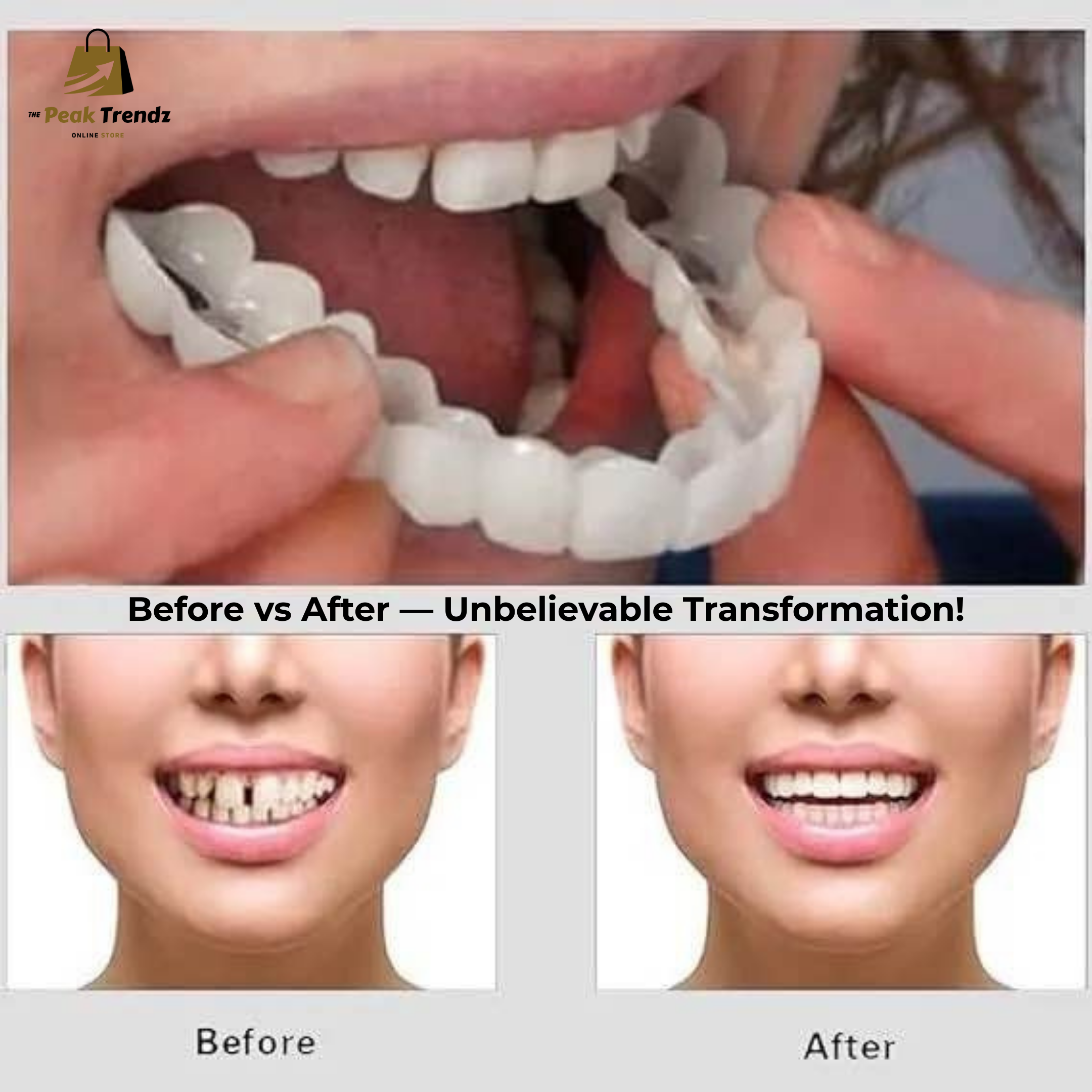 Snap On Smile Teeth Veneers Instant Perfect Smile for Men & Women